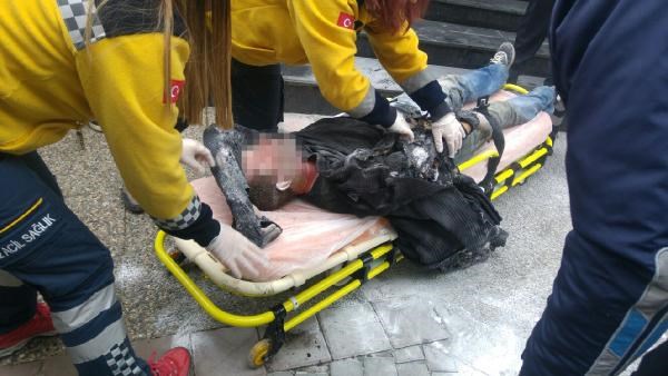 Otro turco en paro se quemó a lo bonzo enfrente del ayuntamiento