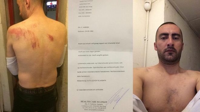 Golpeado y torturado un ciudadano turco en el consulado turco de Rotterdam